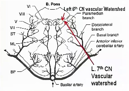 The 6th and 7th cranial nerves (top branches) are at the end of the basilar artery blood supply (bottom center). This makes them most susceptible to circulatory interruptions.