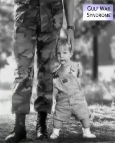 Gulf War Syndrome child