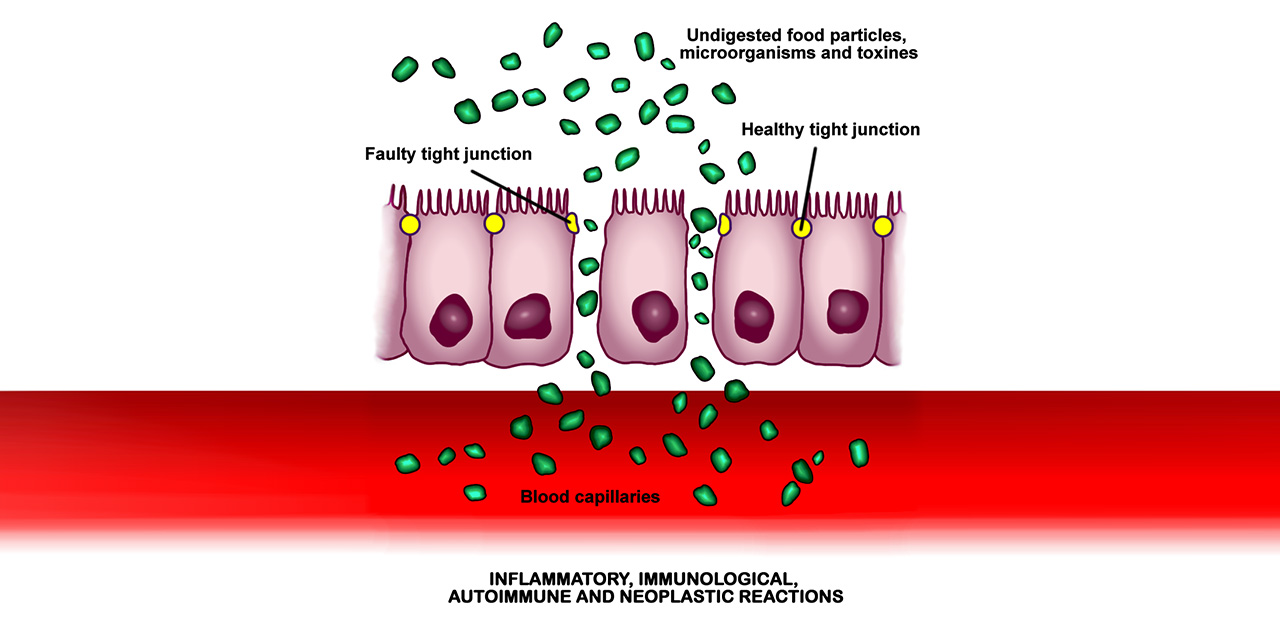 Tight junctions and intestinal permeability