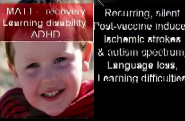 Finally, cranial nerve function is restored, but Matt is left with persistent learning disabilities and ADHD.