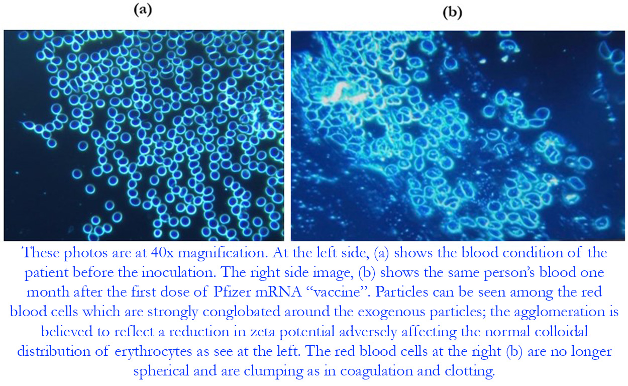 Dark field blood samples before and after vaccination.