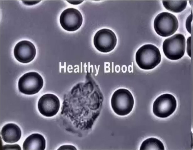 Zeta potential of healthy blood