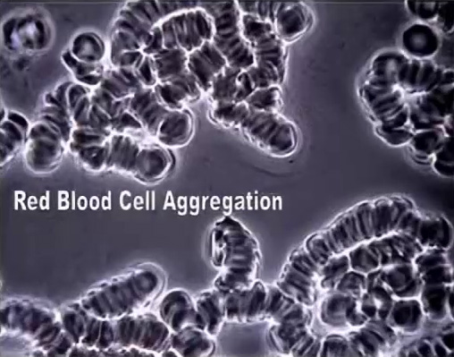 Blood cell agglomeration