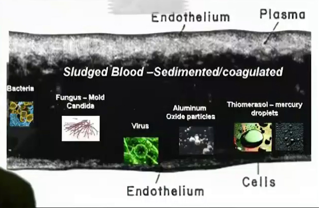 Zeta potential threats